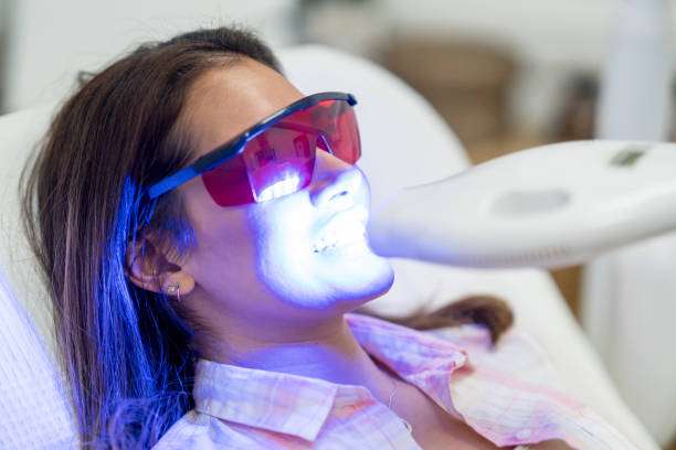 how does teeth whitening work How Does Teeth Whitening Work? how does teeth whitening work How Does Teeth Whitening Work?